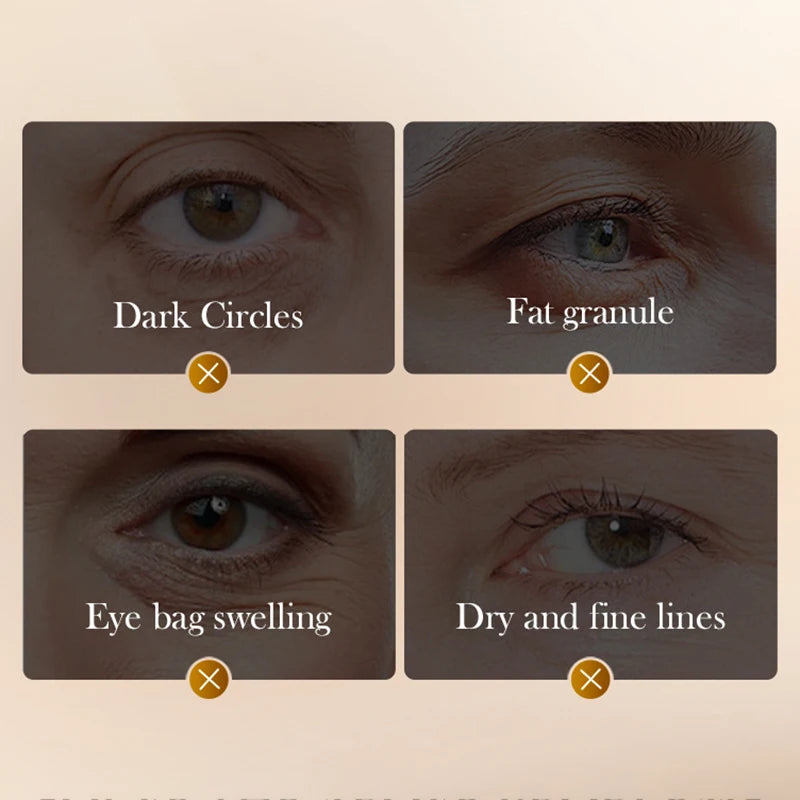 Crema Contorno de Ojos SADOER — Péptido de Veneno de Serpiente + Cafeína, Antiarrugas y Antiojeras